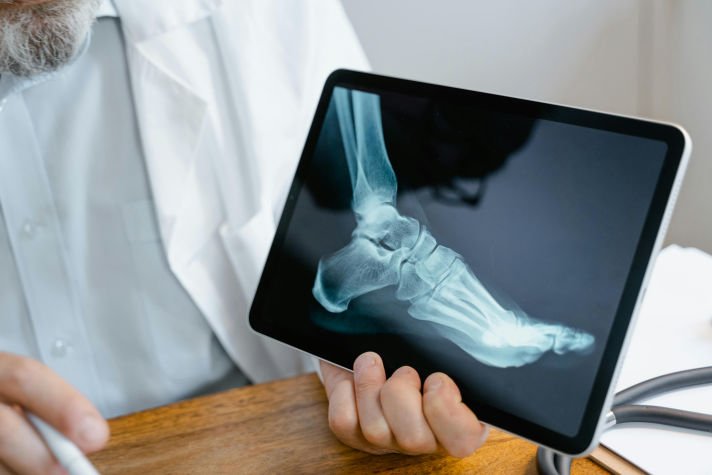 What Is The Bone Density Solution